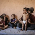 AA 20250714 38554714 38554695 MALNUTRITION CRISIS DEEPENS FOR CHILDREN IN GAZA UNDER ISRAELI BLOCKADE 1