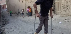 ثبت چهار مورد جدید پولیو در کشور