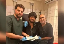 ۳۰ میخ از معده یک بیمار در شفاخانه داود خان خارج شد 2 سایت 399